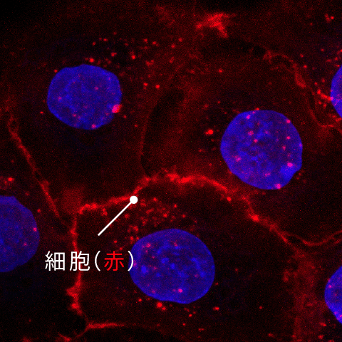 ［表皮］ヒト表皮角化細胞 添加前