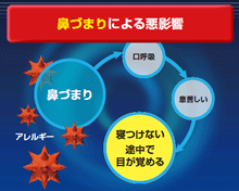 日中 睡眠時などの鼻づまりを改善し 鼻呼吸を楽にする点鼻薬 ロート アルガード クリアノーズ 新発売 ロート製薬株式会社