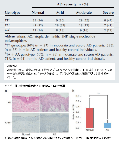 アトピー性皮膚炎とKPRP遺伝子／KPRPタンパク